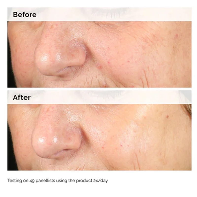 Alpha Arbutin 2% + HA 30ml Ser - Aha Bha Exfoliant ulasan dan harga